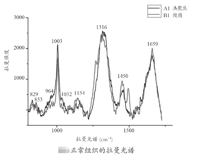 便攜式光纖拉曼胃癌檢測(cè)儀的研發(fā)和應(yīng)用